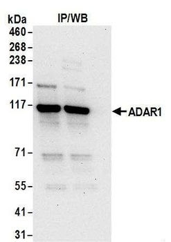 ADAR1 Antibody