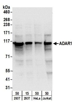 Rabbit ADAR1 Antibody
