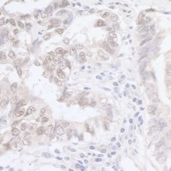 Rabbit anti-ADAR1 Antibody