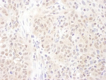 PSME4 Antibody