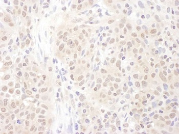 Rabbit anti-PSME4 Antibody