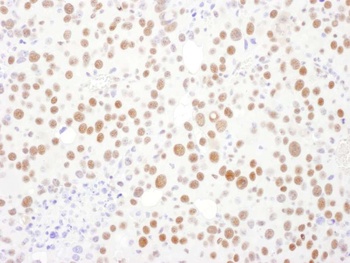 Rabbit anti-PSME3 Antibody