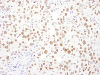 PSME3 Antibody