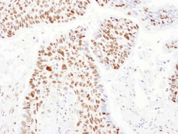Rabbit anti-PSME3 Antibody