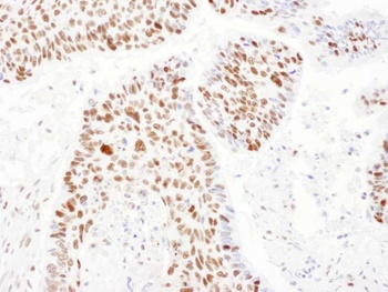 PSME3 Antibody