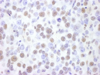 Goat anti-BRG1/SMARCA4 Antibody