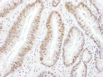 Goat anti-BRG1/SMARCA4 Antibody