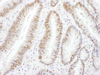 BRG1/SMARCA4 Antibody