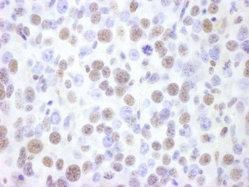 BRG1/SMARCA4 Antibody