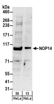 NOP14 Antibody