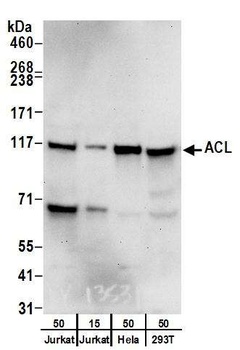 ACL Antibody