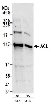 Rabbit ACL Antibody