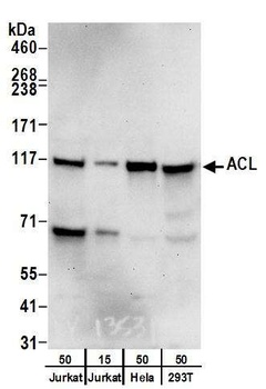 Rabbit ACL Antibody