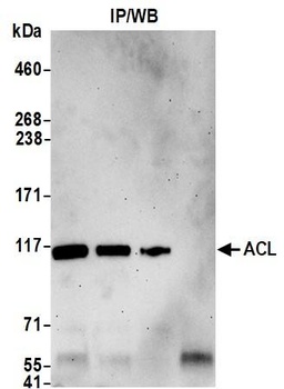 ACL Antibody