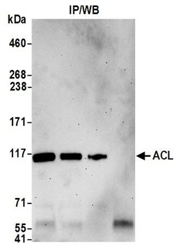 Rabbit ACL Antibody