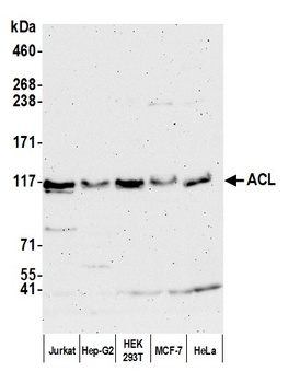 Rabbit ACL Antibody