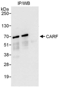 Rabbit anti-CARF Antibody