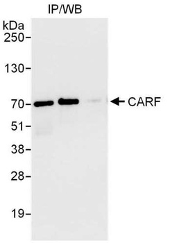 Rabbit anti-CARF Antibody