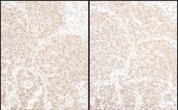 Rabbit anti-PSMD4 Antibody