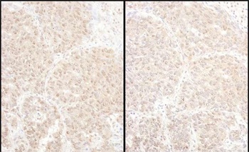 Rabbit anti-PSMD4 Antibody