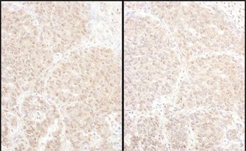 PSMD4 Antibody