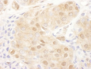 Rabbit anti-PSMD2 Antibody