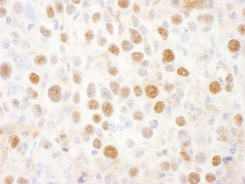 Rabbit anti-PSMD2 Antibody