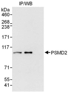 Rabbit anti-PSMD2 Antibody