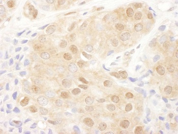 PSMD2 Antibody