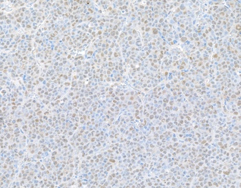 Rabbit anti-PSMD1 Antibody