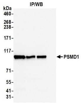 Rabbit anti-PSMD1 Antibody