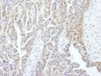 Rabbit anti-PSMD1 Antibody
