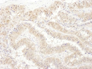 Rabbit anti-PSMC4 Antibody
