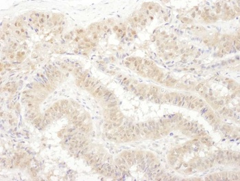 PSMC4 Antibody