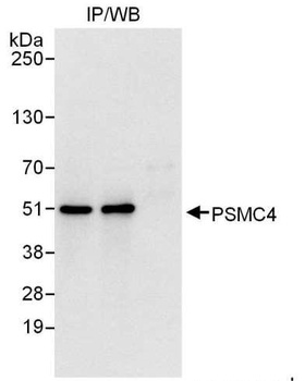 Rabbit anti-PSMC4 Antibody