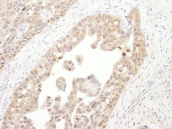 Rabbit anti-PSMC4 Antibody