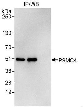 Rabbit anti-PSMC4 Antibody