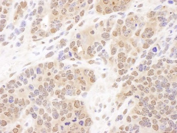 Rabbit anti-PSMB7 Antibody