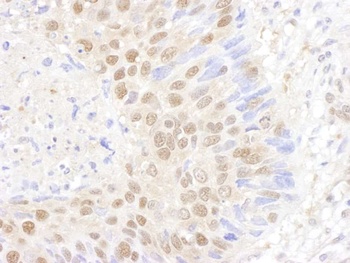 Rabbit anti-PSMB7 Antibody