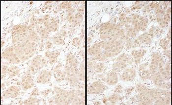 Rabbit anti-PSMA1 Antibody