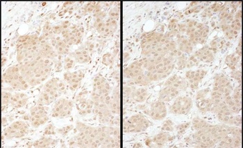 PSMA1 Antibody