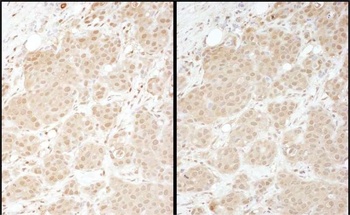 Rabbit anti-PSMA1 Antibody
