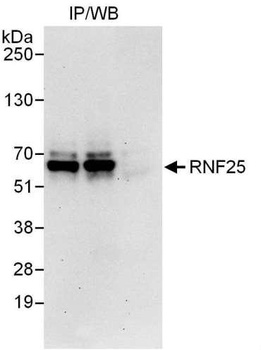 Rabbit anti-RNF25 Antibody