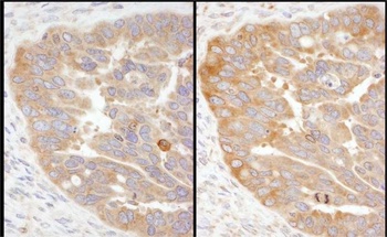 Rabbit anti-RPS3 Antibody