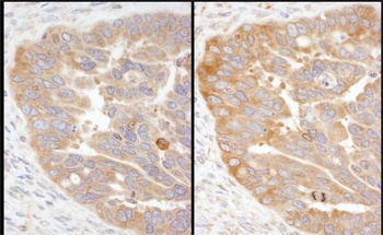 RPS3 Antibody