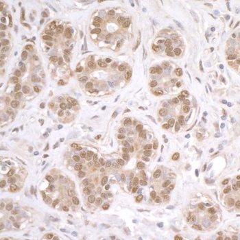Goat anti-FUS Antibody