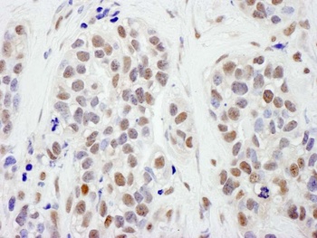 SMC1 Antibody