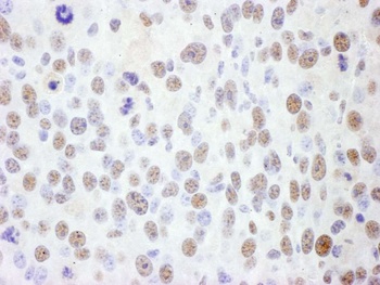 Goat anti-SMC1 Antibody