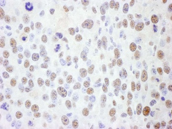 SMC1 Antibody