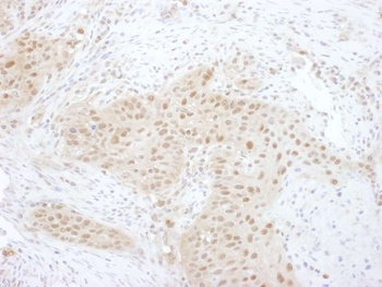 Rabbit anti-PSMD7 Antibody